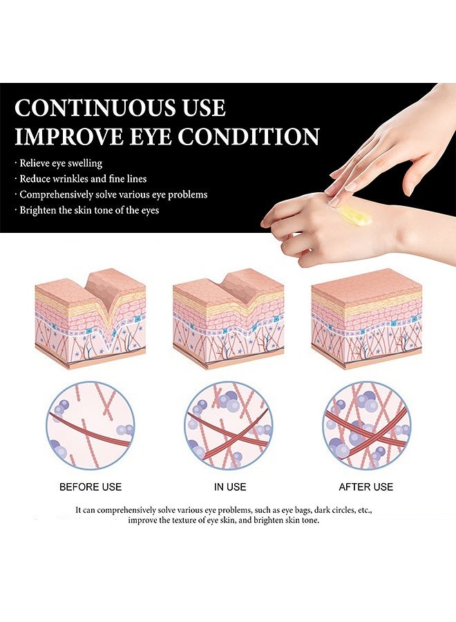 WIYUN Eye Cream-Gentle and moisturizing care for the eye area, with soft massage for delicate skin. Hydrating skin care lotion (30g) - Image 4